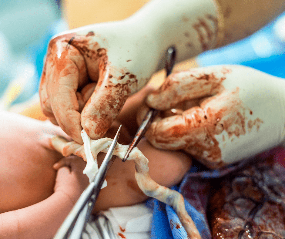 cord clamping
