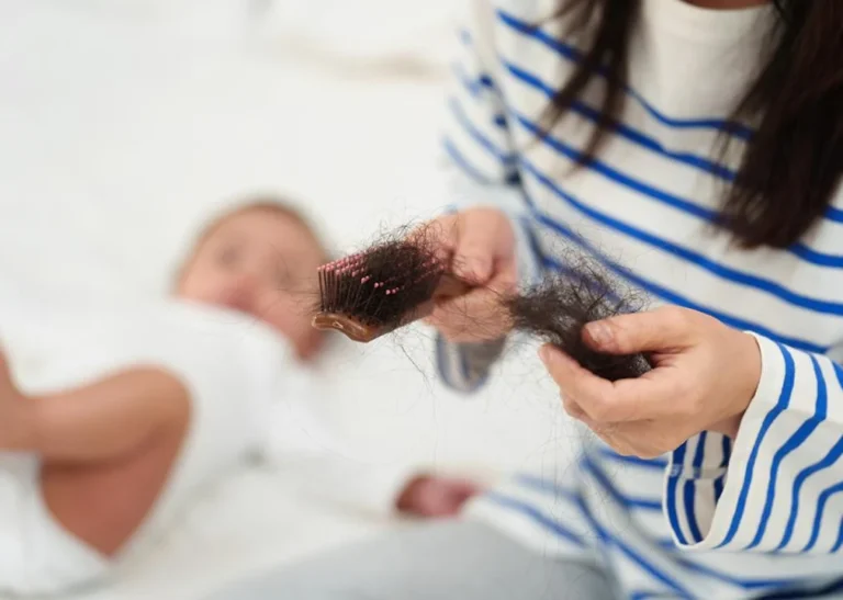 postpartum hair loss- STACKER only, do not resuse